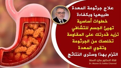 علاج جرثومة المعدة الفعال من الطبيعة نصائح هامة للتخلص منها في مدة وجيزة | علاج جرثومة المعدة طبيعيا