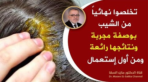 أفضل طرق التخلص من الشيب وازالة الشيب من الشعر نهائيا حتى لوكان الشعر يغزوه الشعر الأبيض نتائج مبهرة