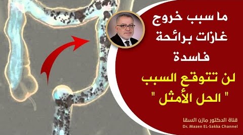 هل تعلم ماهو سبب خروج غازات برائحة كريهة علاج غازات البطن بطرق طبيعية وتنظيف الجسم من البراز المتحجر