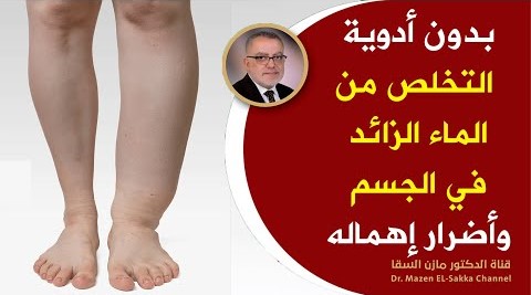 لهذه الأسباب يحتبس الماء في الجسم طرق التخلص من الماء الزائد وعلاج احتباس الماء في الجسم بالاعشاب