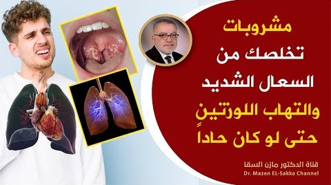 مشروبات تخلصك من السعال وتطهرالجيوب الأنفية واللوزتين وتنقي الصدر من البلغم مهما كان الإلتهاب حاداً