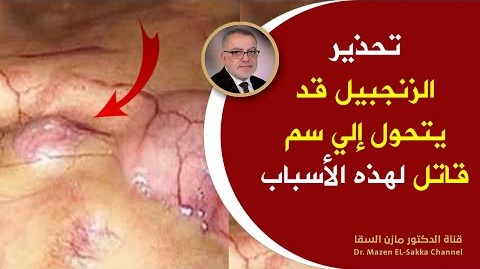 أشخاص إذا تناولوا الزنجبيل يدمرون صحتهم أضرار الزنجبيل التي لم يتحدث عنهاأحد فوائد الزنجبيل قد تنتهي