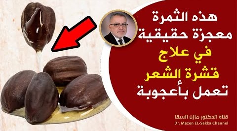 علاج قشرة الشعر والحكة بمكون رهيب استخدمه للشعر وفروة الرأس يعمل بكفاءة ضد القشرة وحبوب الرأس
