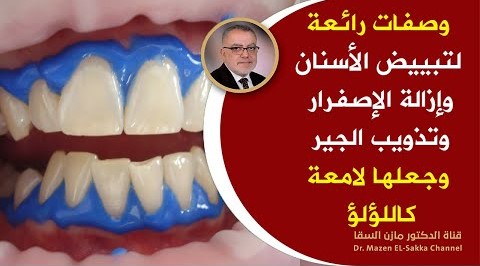 وصفات طبيعية لتبييض الأسنان وازالة الاصفرار وتذويب الجير خطة علاجية تجعلها بيضاء لامعة مثل اللؤلؤ