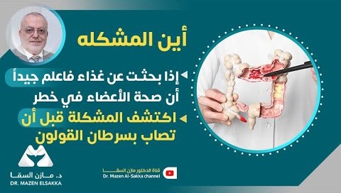 القولون | أين المُشكلة؟ وكيف تتجنبها؟ | الحلقة 1