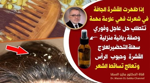 ظهورالقشرة الجافة في الشعررسالة خطيرة من جسمك هكذا تتدخل لعلاج قشرة الرأس الجافة وحكة الرأس والحبوب