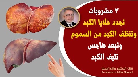 مشروبات تنظف الكبد وتعمل على تجديد خلايا الكبد وانزيماته ستجعل كبدك جديداً وستبدو بصحة أفضل وأصغرسنا