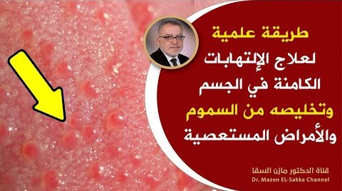 طريقة علمية لتقوية جهاز المناعة وتنظيف الجسم من السموم وعلاج الأمراض الصعبة والقضاء على أي التهابات