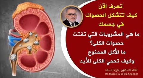 أفضل علاج لـ تفتيت حصى الكلى من اليوم قل وداعا لحصى الكلى أمر هام في تفتيت وتنظيف الكليتان من الحصى