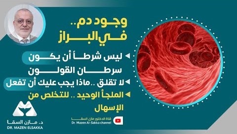 القولون | أعراض ومشاكل القولون الأسباب، الأعراض، والحلول الفعّالة | حلقة 4