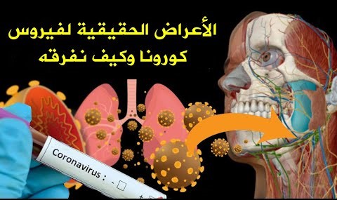 تعرف على أعراض فيروس كورونا التي يتجاهلها الكثير من الناس الأعراض الحقيقية لفيروس كورونا وكيف نفرق