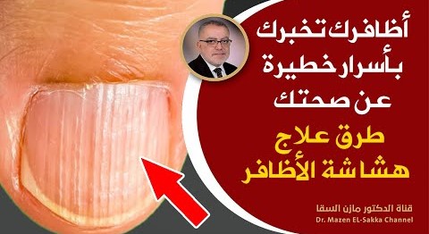فلينتبه لها الجميع أظافرك تخبر بأسرار خطيرة عن صحتك وصفة طبيعية لتقوية الاظافر وجعلها قوية وبيضاء