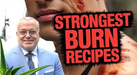 🔥 وداعًا للوصفات الخاطئة! إليك أقوى الوصفات لإزالة آثار الحروق بفعالية مدهشة