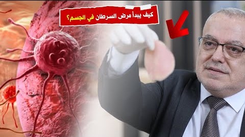 كيف يبدأ مرض السرطان في الجسم؟ هل من الممكن الشفاء التام من السرطان | افهم جسدك | الوقاية من السرطان
