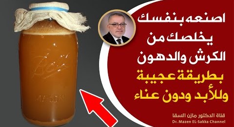 كيفيه التخلص من الكرش بسرعة والى الأبدوصفة تحرق دهون البطن والكرش تخفض الكولسترول وتطرد السموم بسرعة