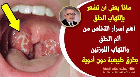 سرمن أسرارتنظيف الحلق والقضاء على ألم والتهاب الحلق بعلاج فعال فوري يخلصك من التهاب اللوزتين وتضخمها