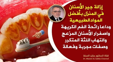 إزالة جيرالاسنان منزليا وداعا رائحة اللثة الكريهة علاج تآكل مينا الأسنان طرق طبيعية لتبييض الاسنان
