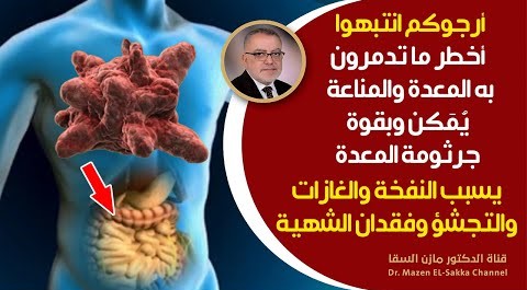 علاج جرثومة المعدة من الطبيعة لن يتم لأن أخطر أسباب جرثومة المعدة موجود ويهمله البشر ارجوكم انتبهوا