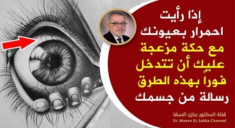 إذا وجدت احمرار أو حكة في العين عند استيقاظك من النوم فهي علامة ضرورية لا تتجاهلها إذا ظهرت في جسمك