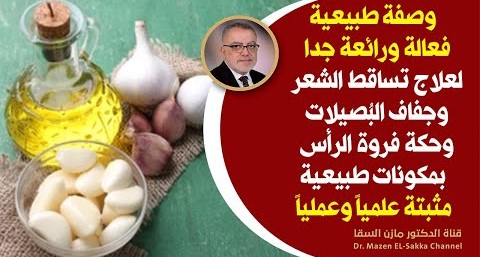 شاهدوا معجزة الثوم مع زيت الزيتون في علاج مشكلة صحية يعاني منها 99% من البشر إنها فروة الرأس يا سادة