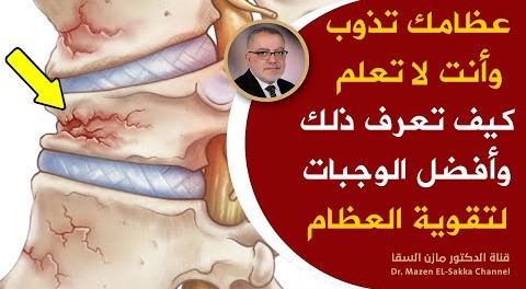 علاج هشاشة العظام الفعال أعظم دواءلعلاج هشاشةالعظام والتهاب المفاصل معلومات تخلصك من ألم العظام حالا