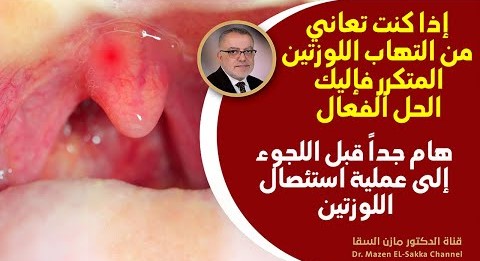 كيف تتخلص من التهاب اللوزتين والحلق بأسرع وقت وهل الحل عملية استئصال اللوز لماذا يحدث الالتهاب أصلا