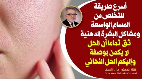إذا أردتم اسرع طريقة للتخلص من المسام الواسعة والبشرة الدهنيةهنا الحل النهائي للتخلص من المسام واسعة