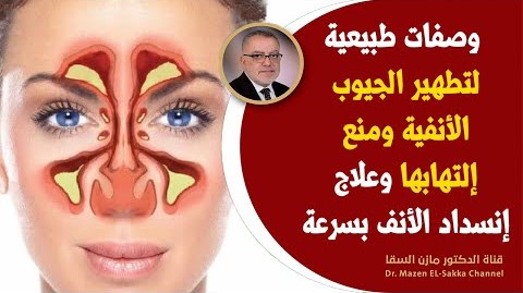 أفضل طرق تنظيف الجيوب الأنفية والجهاز التنفسي وصية العلماء لعلاج التهابات الجيوب الأنفية طبيعياً