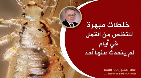 هل تعلم ماأسباب ظهور قمل شعر الرأس وأسهل طرق التخلص من القمل علاج القمل نهائيا بطرق طبيعية