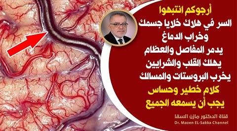 أعظم سريسبب هلاك الخلايا يدمر المفاصل يهلك القلب والرئة يخرب البروستات والمسالك يعفن القولون والمعدة