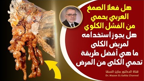هل فعلا الصمغ العربي يحمي من الفشل الكلوي؟ وما أفضل طريقة لحماية الكلى للأبد أنشروها جزاكم الله خيرا
