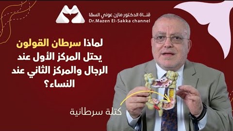 مؤشرات سرطان القولون في بدايته وكيفية علاج الاسباب كلام مهم جدا