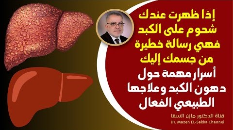 شحوم على الكبد إنها رسالة هامة من جسمك | دهون الكبد وعلاجها الفعال | أسهل طريقة لإزالة دهون الكبد