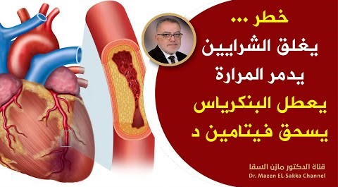 كارثة صحية لم ينتبه لها أحد إنه يحرق خلايا الجسم يدمرالمرارة يعطل البنكرياس ويسحق فيتامين دال بالجسم