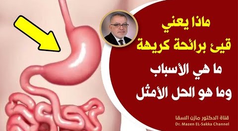 ما هوسبب خروج قيئ برائحة كريهة علاج المعدة طبيعيا وتنظيف التهاب المعدة من التعفن افضل علاج للمعدة