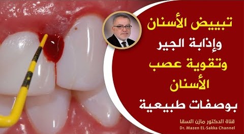 لكل من يريد تبييض الاسنان أسباب خفية لاصفرار الاسنان وطرق التخلص من جير الاسنان بوصفات طبيعية