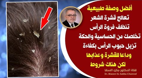 أعظم الهدايا الربانية يعمل ضد القشرة يعالج تساقط الشعربقوة يكافح القشره وحبوب وحكة فروة الرأس بكفاءة