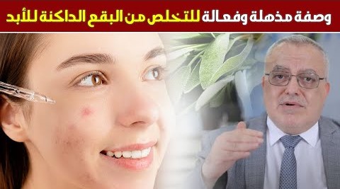 مادة طبيعية للتخلص من تصبغات البشرة والبقع الداكنة في أيام نطاق تقليل البقع الداكنة الأخطاء الكارثية