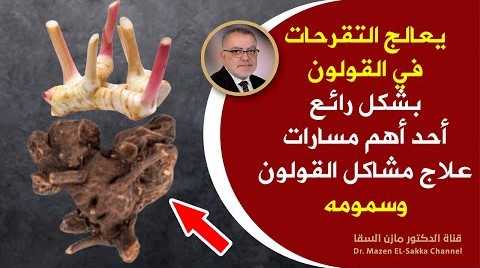 طريقة تنظيف القولون من البرازالمتحجر والتقرحات وتنظيف البطن والامعاء من السموم باستخدام الخولنجان
