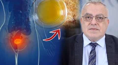 أقوى علاج طبيعي لحرقة وألام الجهاز البولي كثرة التبول وعسر البول حرقان مصاحب للتبول تضخم البروستات