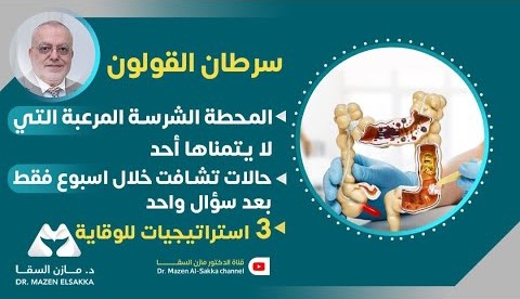 القولون | الوقاية من سرطان القولون والكشف المبكر | الحلقة 8